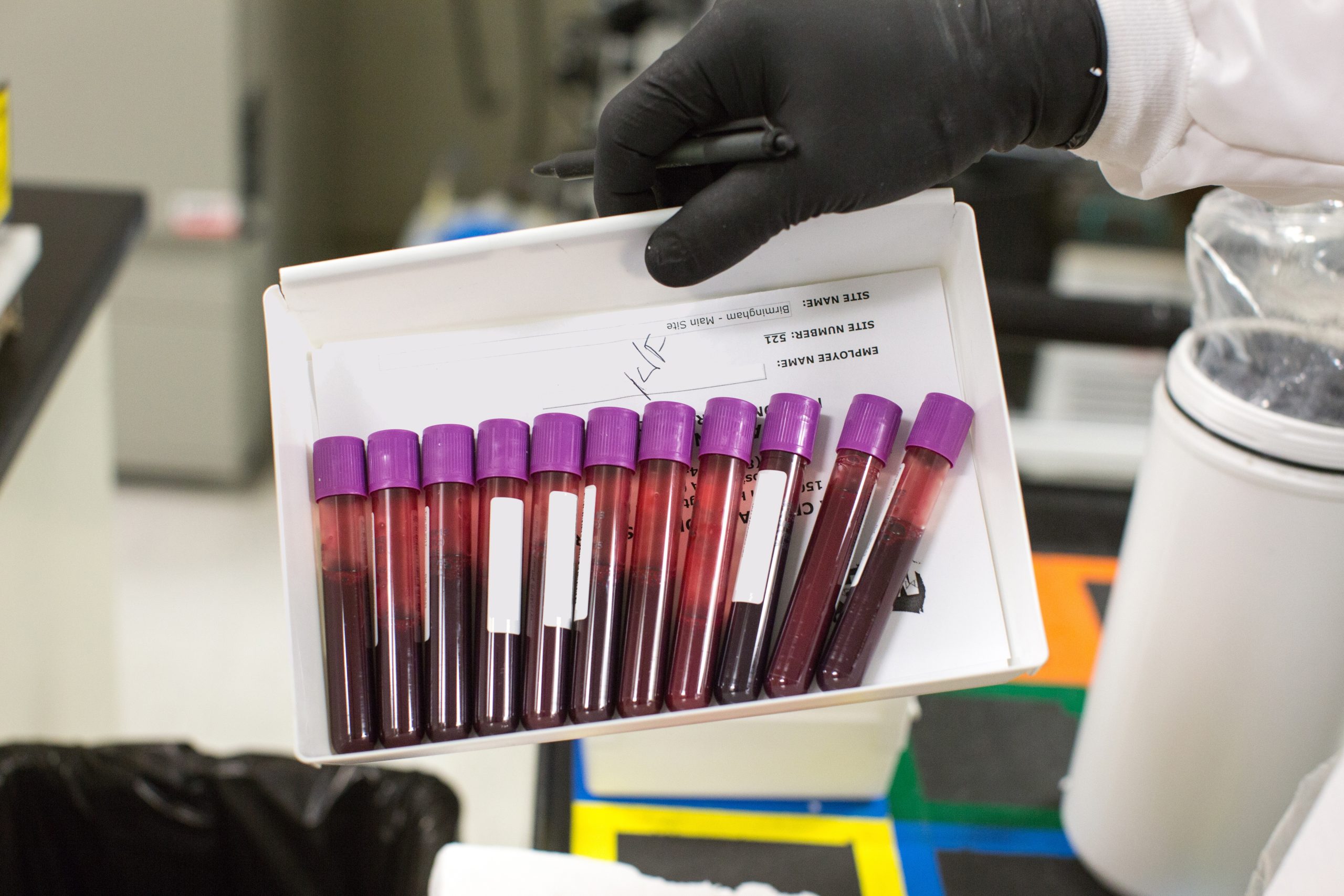 Blood samples collected from Veteran volunteers participating in VA’s Million Veteran Program. The samples are sent to a state-of-the-art biobank at the VA Boston Healthcare System, where machines extract DNA, proteins, and other molecules for genetic analysis. (MVP)