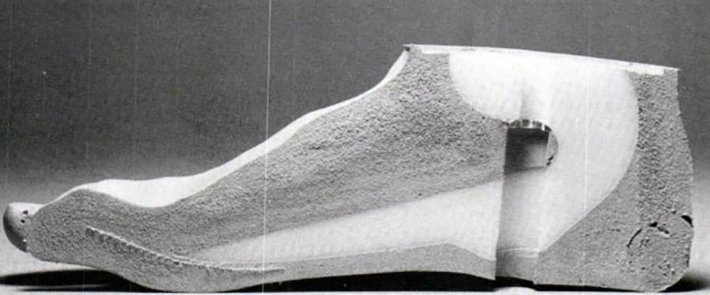 PDF) Transtibial amputee gait efficiency: Energy storage and return versus solid  ankle cushioned heel prosthetic feet