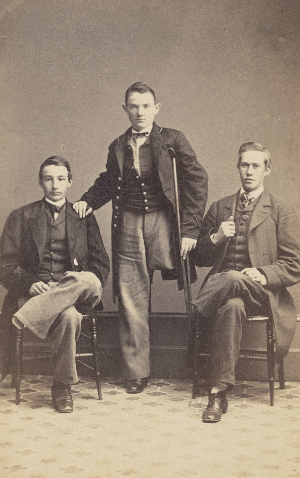 Three Union Veterans and left-leg amputees pose for a picture, circa late 1860s. All three were wounded during the fighting in 1863. (Library of Congress)
