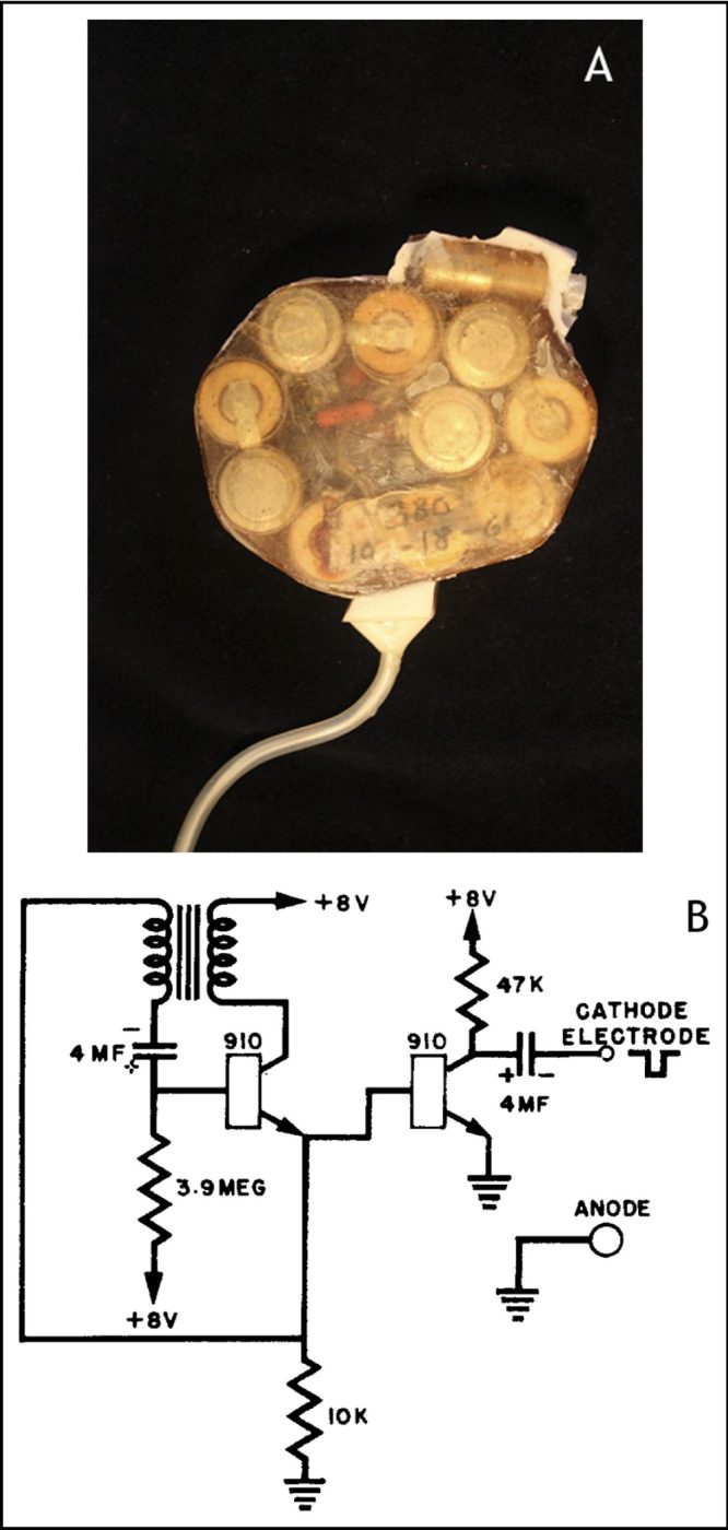 Battery pack and circuitry of one of the first implantable cardiac pacemakers. (American Journal of Cardiology)